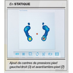 software pressmat análisis estático